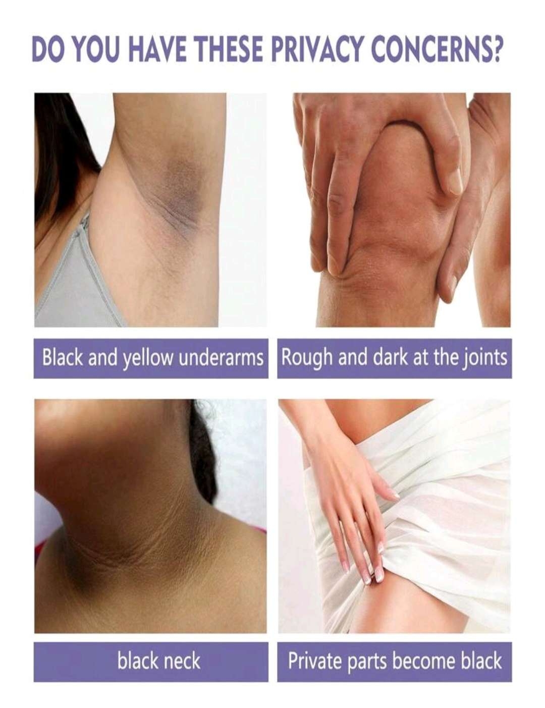 تبييض عصا جلد , مضاد للعرق2