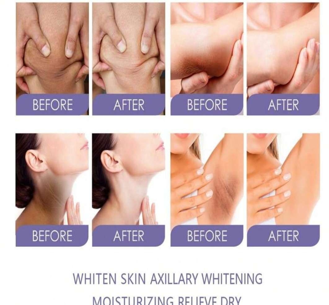 تبييض عصا جلد , مضاد للعرق7